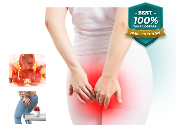 klinik wasir nusantara